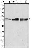 Anti-AKT2 antibody [1B6] used in Western Blot (WB). GTX83257