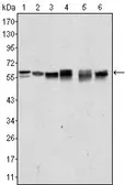 Anti-AKT2 antibody [1B6] used in Western Blot (WB). GTX83257