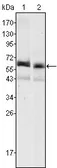 Anti-Alpha fetoprotein / AFP antibody [6E6] used in Western Blot (WB). GTX83261
