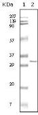 Anti-HPRT antibody [1F8D11] used in Western Blot (WB). GTX83262