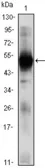 Anti-RAG2 antibody [4D5] used in Western Blot (WB). GTX83284