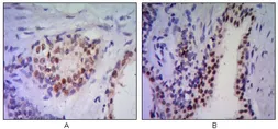 Anti-Nkx3.1 antibody [4H4] used in IHC (Paraffin sections) (IHC-P). GTX83288