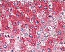 Anti-FGFR4 antibody [4H2B10B2] used in IHC (Paraffin sections) (IHC-P). GTX83291