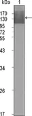Anti-VEGF Receptor 2 antibody [4B4] used in Western Blot (WB). GTX83308