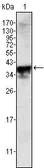 Anti-Androgen Receptor antibody [2H8] used in Western Blot (WB). GTX83309