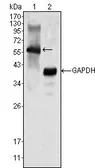 Anti-MATK antibody [9D7] used in Western Blot (WB). GTX83311