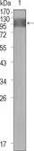 Anti-VEGF Receptor 1 antibody [3D10] used in Western Blot (WB). GTX83314