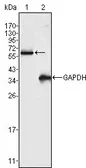 Anti-FRK antibody [4E1] used in Western Blot (WB). GTX83317