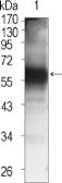 Anti-Tec antibody [3A5] used in Western Blot (WB). GTX83318