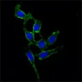 Anti-FAK antibody [10H7E9] used in Immunocytochemistry/ Immunofluorescence (ICC/IF). GTX83323