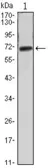 Anti-FAK antibody [10H7A6] used in Western Blot (WB). GTX83324