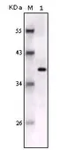 Anti-S100 beta antibody [9A11B9] used in Western Blot (WB). GTX83327