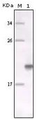 Anti-MERTK antibody [7E5G1] used in Western Blot (WB). GTX83328
