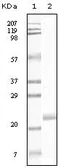 Anti-EphB4 antibody [5B8F7] used in Western Blot (WB). GTX83333