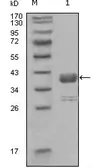 Anti-c-Abl antibody [7B11D6] used in Western Blot (WB). GTX83337