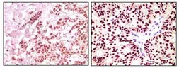 Anti-Estrogen Receptor alpha antibody [2B7] used in IHC (Paraffin sections) (IHC-P). GTX83349