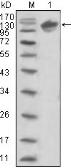 Anti-Her3 / ErbB3 antibody [2F9] used in Western Blot (WB). GTX83364