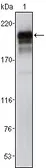 Anti-PDGF Receptor beta antibody [1A2] used in Western Blot (WB). GTX83371