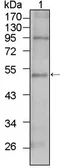 Anti-TBX5 antibody [7B11] used in Western Blot (WB). GTX83374