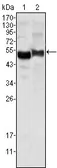 Anti-alpha 1 Antitrypsin antibody [2B12] used in Western Blot (WB). GTX83379