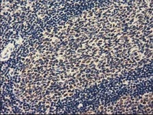 Anti-ZIM2 antibody [7G1] used in IHC (Paraffin sections) (IHC-P). GTX83402