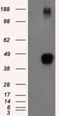 Anti-Tristetraprolin antibody [8B5] used in Western Blot (WB). GTX83404