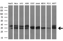 Anti-Tristetraprolin antibody [3D10] used in Western Blot (WB). GTX83405
