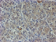Anti-VEGFA antibody [4G3] used in IHC (Paraffin sections) (IHC-P). GTX83425