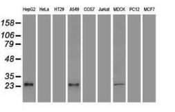 Anti-VEGF antibody [4G3] used in Western Blot (WB). GTX83425