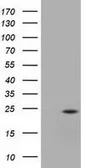 Anti-UBE2T antibody [2F5] used in Western Blot (WB). GTX83452