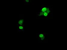 Anti-UBE2T antibody [2F5] used in Immunocytochemistry/ Immunofluorescence (ICC/IF). GTX83452