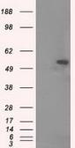 Anti-alpha Tubulin 8 antibody [2G6] used in Western Blot (WB). GTX83462