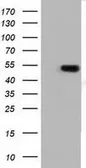 Anti-TUBA3E antibody [10B4] used in Western Blot (WB). GTX83465
