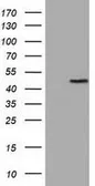 Anti-TUBA3E antibody [2B4] used in Western Blot (WB). GTX83466