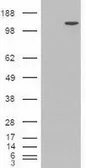 Anti-TIF1 gamma antibody [9D4] used in Western Blot (WB). GTX83492