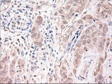 Anti-TIF1 gamma antibody [6B7] used in IHC (Paraffin sections) (IHC-P). GTX83493