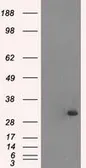 Anti-Cardiac Troponin I antibody [4A3] used in Western Blot (WB). GTX83501