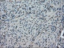 Anti-TMEM100 antibody [1F8] used in IHC (Paraffin sections) (IHC-P). GTX83507
