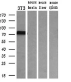 Anti-Transferrin antibody [5G2] used in Western Blot (WB). GTX83513