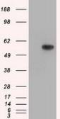 Anti-TXA synthase antibody [2C1] used in Western Blot (WB). GTX83523