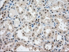 Anti-TACC3 antibody [8F6] used in IHC (Paraffin sections) (IHC-P). GTX83534