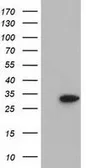 Anti-SULT2A1 antibody [4D7] used in Western Blot (WB). GTX83539