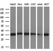 Anti-SULT2A1 antibody [7G10] used in Western Blot (WB). GTX83540