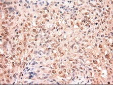 Anti-STAT5A antibody [4H1] used in IHC (Paraffin sections) (IHC-P). GTX83547