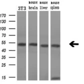 Anti-SSB antibody [1E11] used in Western Blot (WB). GTX83558