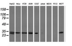 Anti-SPR antibody [3A9] used in Western Blot (WB). GTX83574
