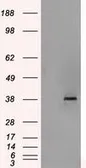 Anti-Sorbitol Dehydrogenase antibody [2A10] used in Western Blot (WB). GTX83583