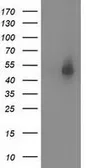 Anti-Syntrophin alpha 1 antibody [1H10] used in Western Blot (WB). GTX83607