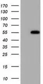 Anti-SMAD2 antibody [2C10] used in Western Blot (WB). GTX83612