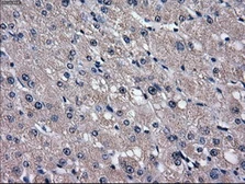 Anti-GLUT5 antibody [20E1] used in IHC (Paraffin sections) (IHC-P). GTX83631